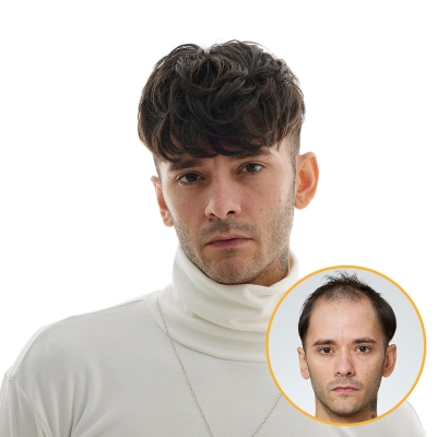 GloWigs Fine Mono Hair System with PU Sides, Back and Scallop Front