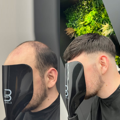 GloWigs 0.08mm Transparent Poly Skin Hair System, 100% Density