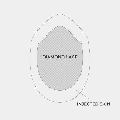 AvenHair Injected Skin Hair System with Diamond Lace