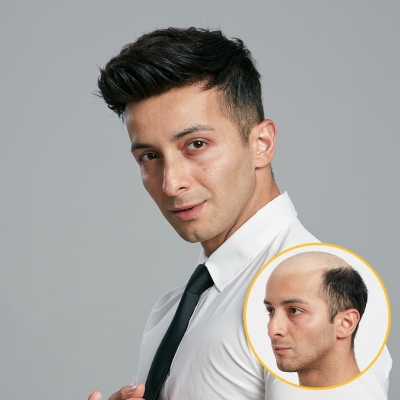 AvenHair Flex Lace Hair System with PU Perimeter