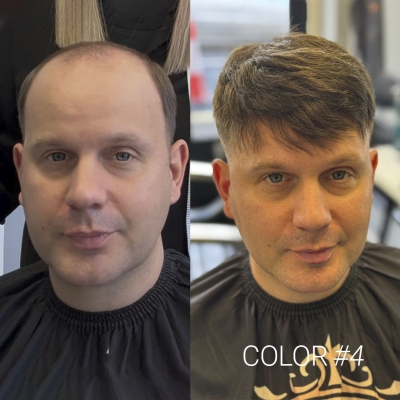 AvenHair HOLLYWOOD Hair System with Thin Skin Perimeter and Lace Front