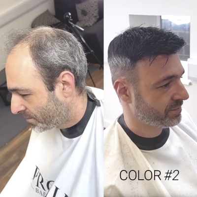 AvenHair Injected Thin Skin Hair System with European Virgin Hair