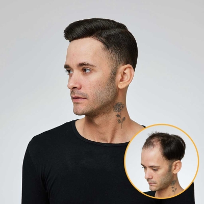 AvenHair Medium Density French Lace Hair System with PU Sides and Back
