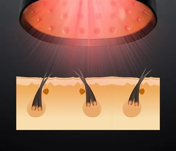 ReHair Laser Hair Growth Cap | Laser Cap for Hair Loss Rehair Laser