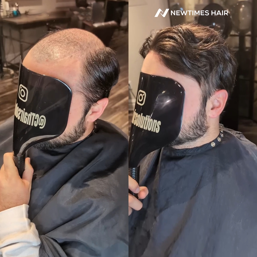 AvenHair French Lace Hair System with Natural Hairline