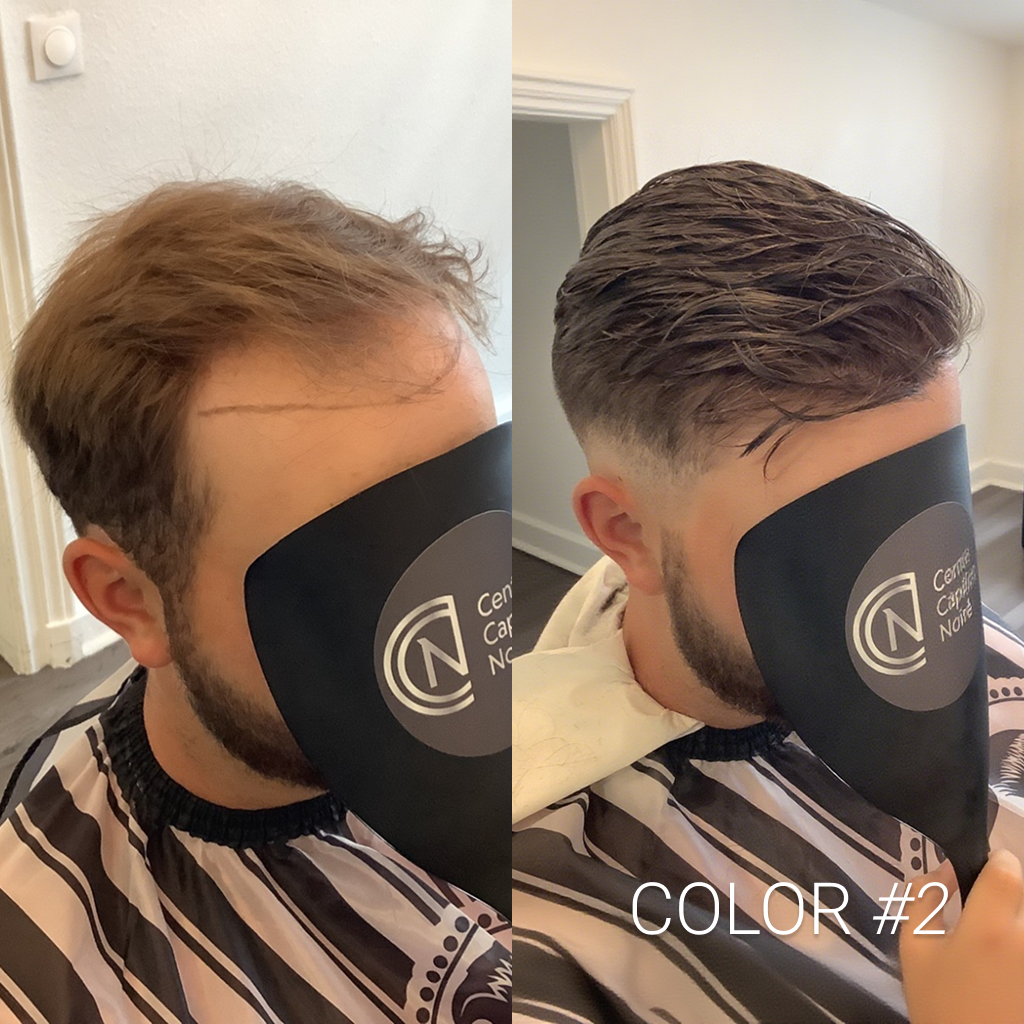 AvenHair 0.06mm Poly Thin Skin Hair System with V-Looped Hair