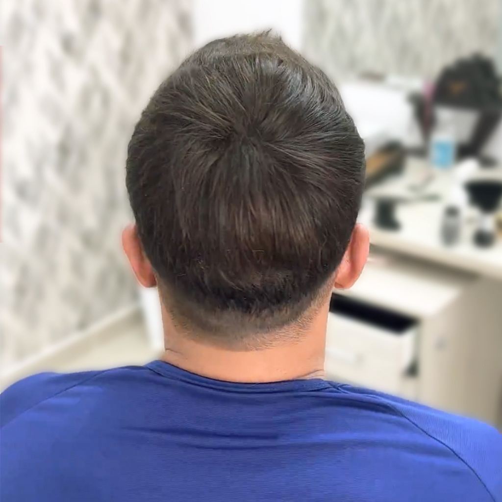AvenHair Flex Lace Hair System with PU Back and Sides