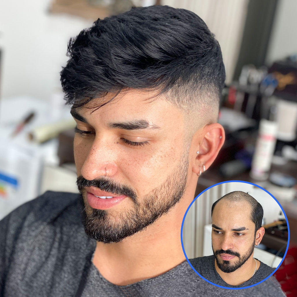 AvenHair 0.08mm Thin Skin Hair System with V-Looped Hair