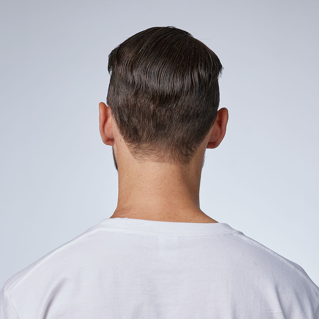 AvenHair Fine Mono Hair System with Skin Gauze Perimeter and Lace Front